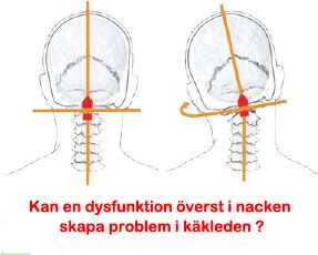 Dysfunktion översta i nacken 