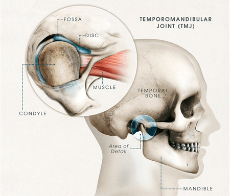 Käkled TMJ
