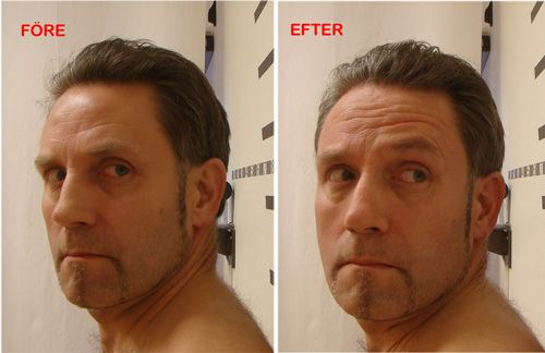 Bilder vridning åt sidan före och efter behandlingen